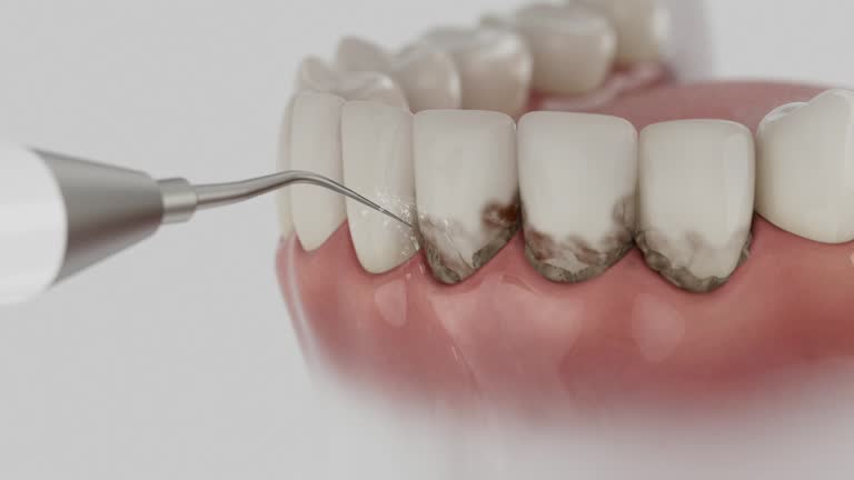 Reliable Dental Implants contractor in Los Alamos, CA by Smile Center Dentistry